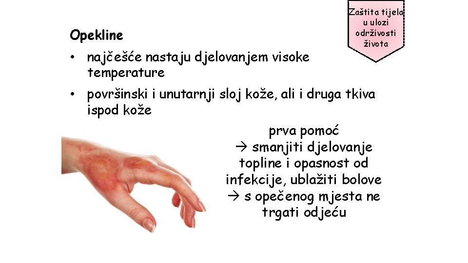 Opekline • najčešće nastaju djelovanjem visoke temperature Zaštita tijela u ulozi održivosti života •