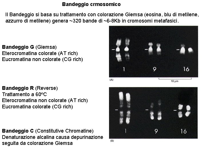 Bandeggio crmosomico Il Bandeggio si basa su trattamento con colorazione Giemsa (eosina, blu di