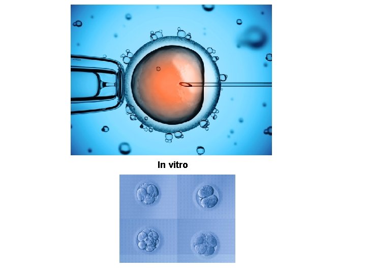 In vitro 