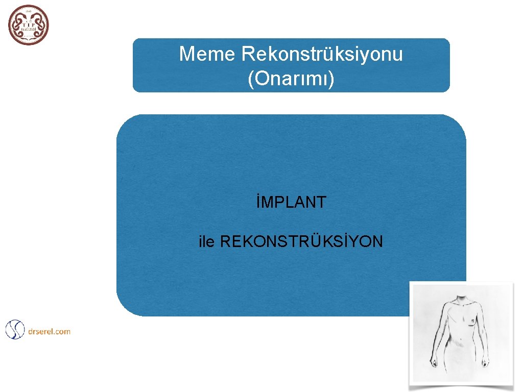 Meme Rekonstrüksiyonu (Onarımı) İMPLANT ile REKONSTRÜKSİYON 