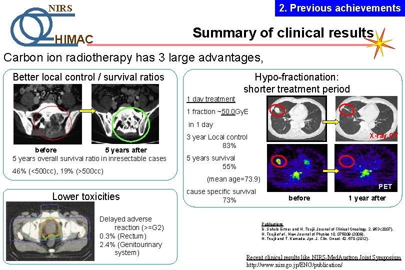 2. Previous achievements NIRS Summary of clinical results HIMAC Carbon ion radiotherapy has 3