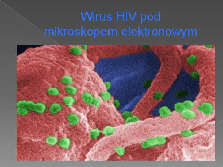 Wirus HIV pod mikroskopem elektronowym 