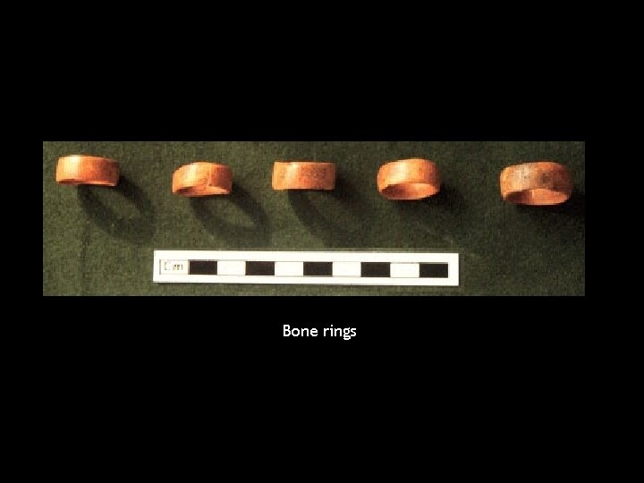 Bone rings 