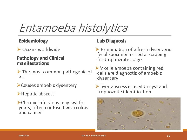 Entamoeba histolytica Epidemiology Lab Diagnosis Ø Occurs worldwide Ø Examination of a fresh dysenteric