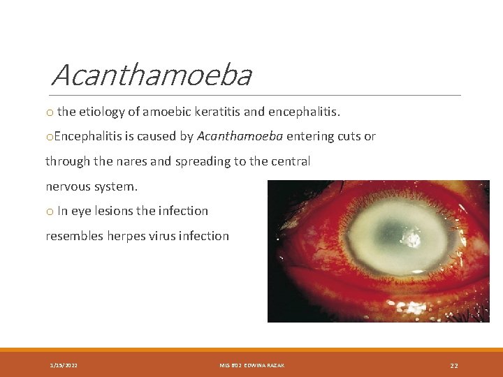Acanthamoeba o the etiology of amoebic keratitis and encephalitis. o. Encephalitis is caused by