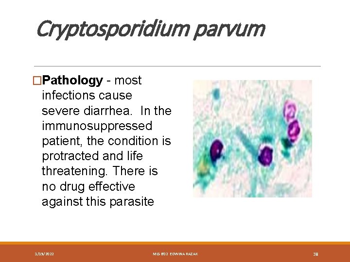 Cryptosporidium parvum �Pathology - most infections cause severe diarrhea. In the immunosuppressed patient, the