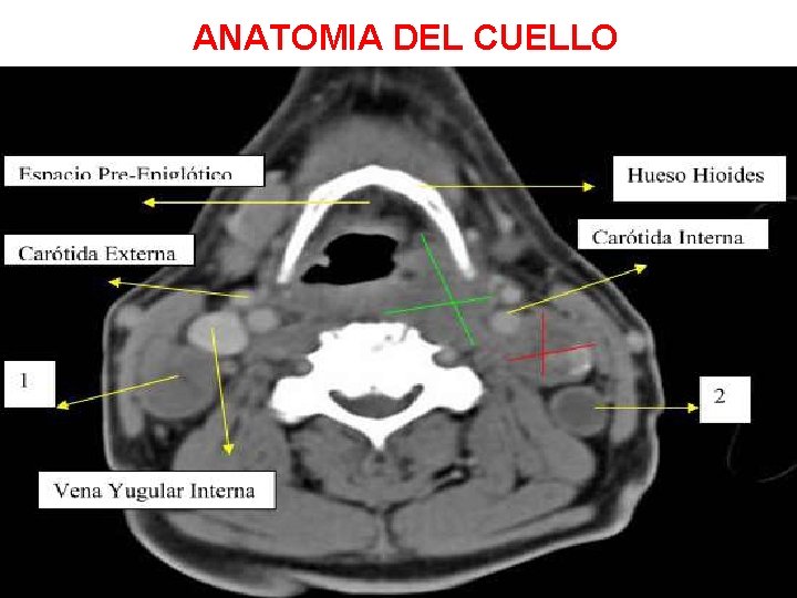 ANATOMIA DEL CUELLO 