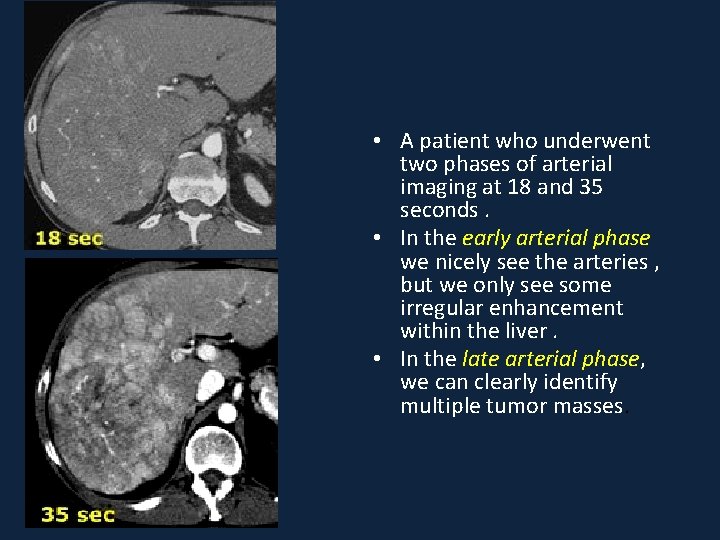  • A patient who underwent two phases of arterial imaging at 18 and