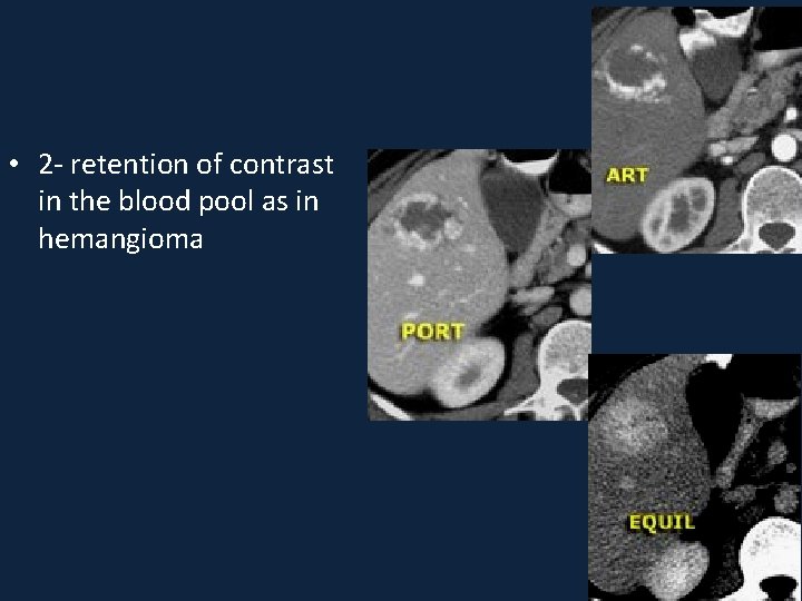  • 2 - retention of contrast in the blood pool as in hemangioma