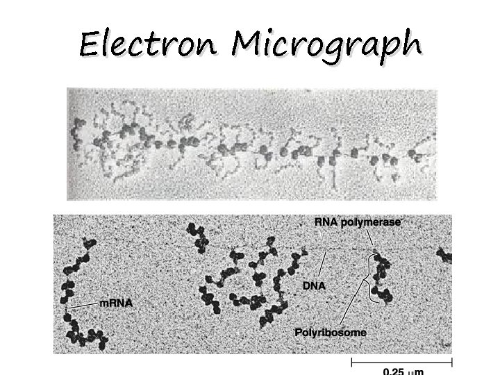 Electron Micrograph 