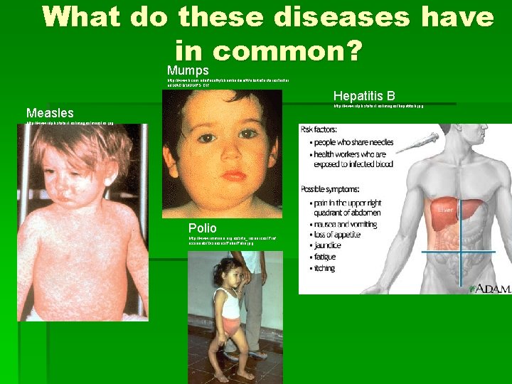 What do these diseases have in common? Mumps http: //www. kcom. edu/faculty/chamberlain/Website/lectures/lectur e/IMAGE/MUMPS. GIF
