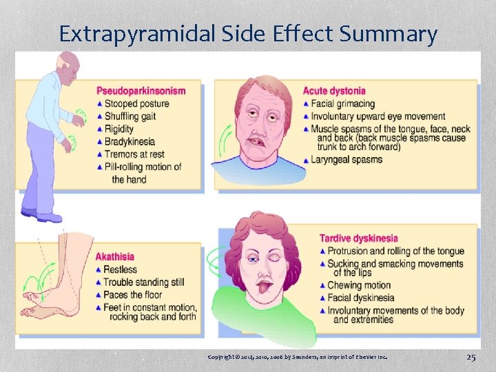 Extrapyramidal Side Effect Summary Copyright © 2014, 2010, 2006 by Saunders, an imprint of