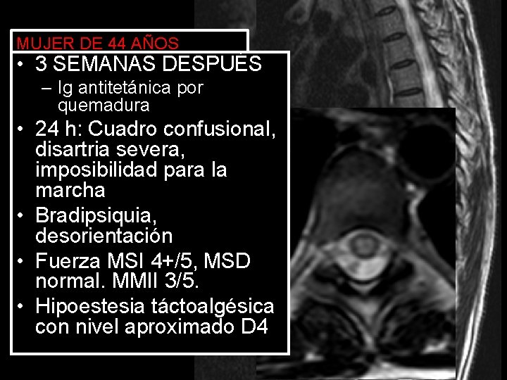 MUJER DE 44 AÑOS • 3– SEMANAS Caída casual DESPUÉS – antitetánica por –