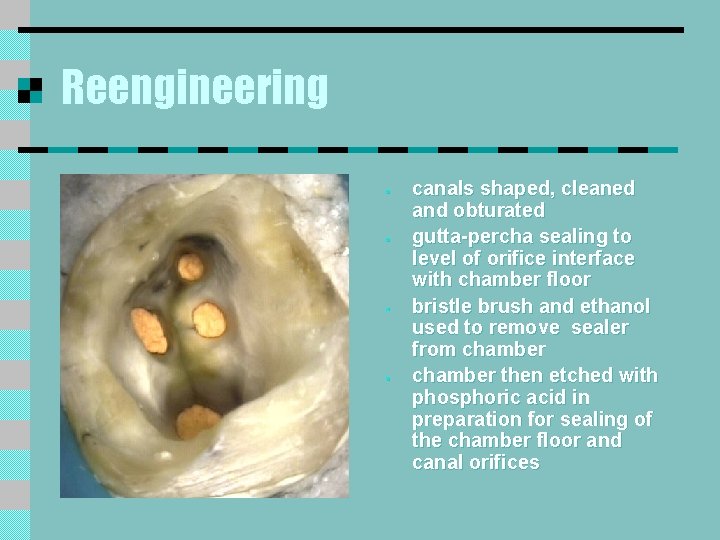 Reengineering § § canals shaped, cleaned and obturated gutta-percha sealing to level of orifice