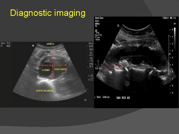 Diagnostic imaging 