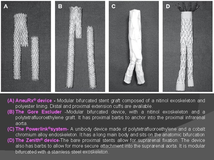 (A) Aneu. Rx® device - Modular bifurcated stent graft composed of a nitinol exoskeleton