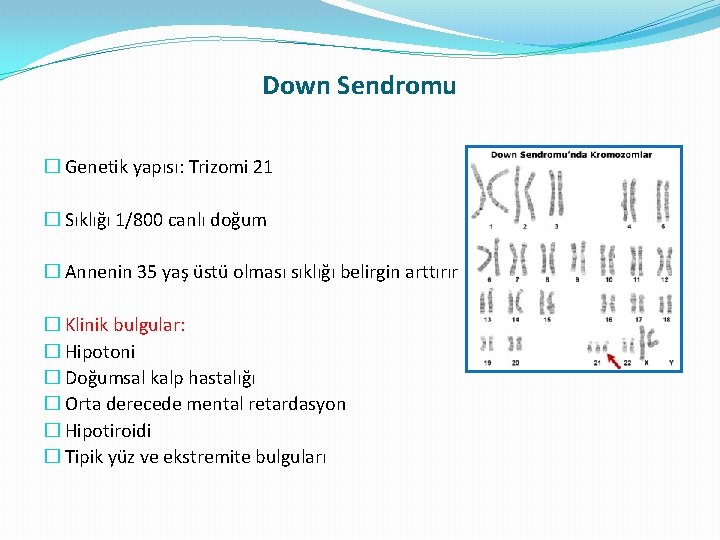 Down Sendromu � Genetik yapısı: Trizomi 21 � Sıklığı 1/800 canlı doğum � Annenin Down Sendromu � Genetik yapısı: Trizomi 21 � Sıklığı 1/800 canlı doğum � Annenin