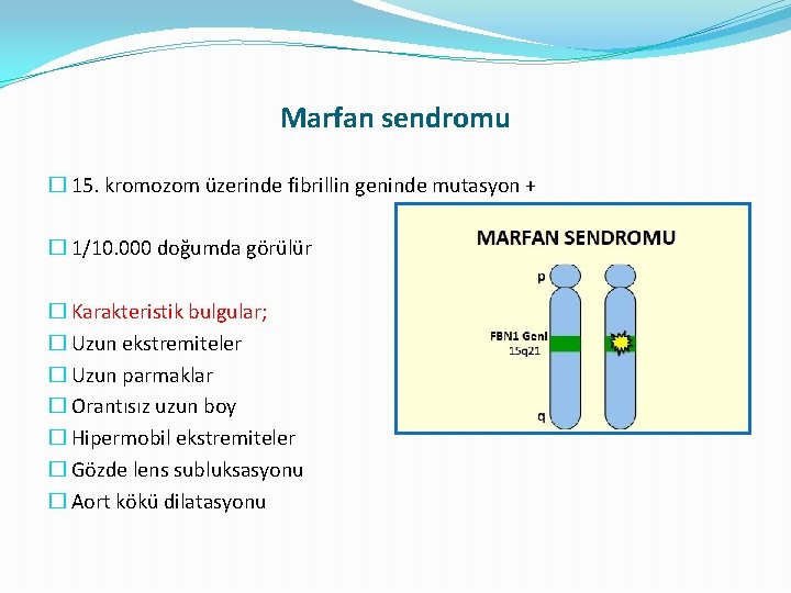 Marfan sendromu � 15. kromozom üzerinde fibrillin geninde mutasyon + � 1/10. 000 doğumda Marfan sendromu � 15. kromozom üzerinde fibrillin geninde mutasyon + � 1/10. 000 doğumda