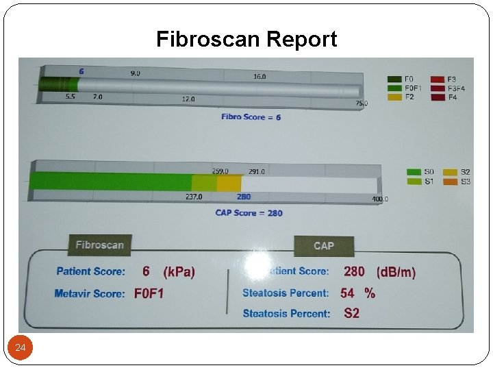 Fibroscan Report 24 