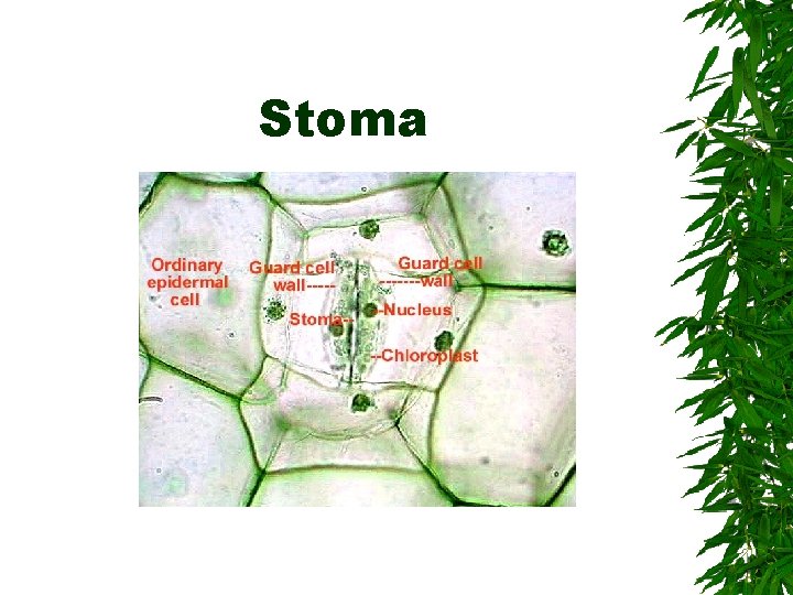 Stoma 