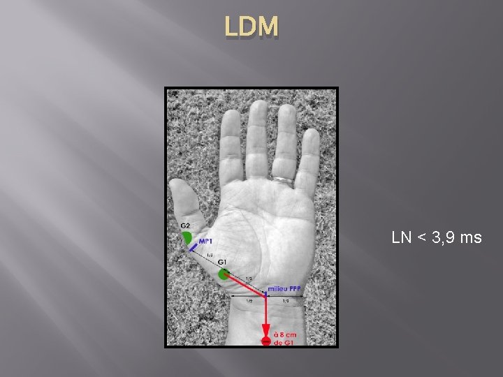 LDM LN < 3, 9 ms 