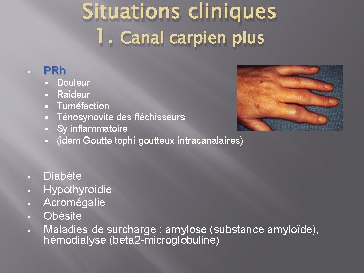 Situations cliniques 1. Canal carpien plus § PRh § § § Douleur Raideur Tuméfaction