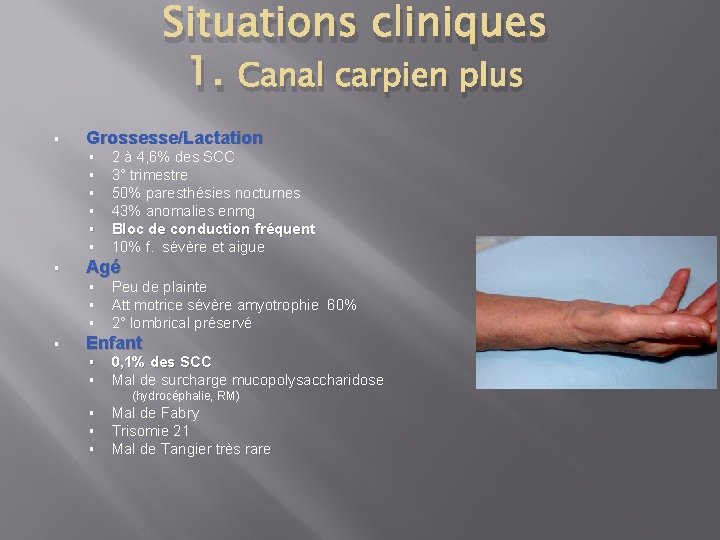 Situations cliniques 1. Canal carpien plus § Grossesse/Lactation § § § § Agé §