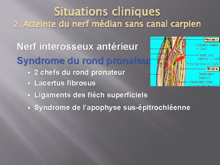 Situations cliniques 2. Atteinte du nerf médian sans canal carpien Nerf interosseux antérieur Syndrome