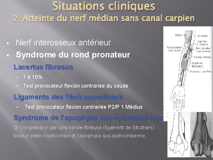 Situations cliniques 2. Atteinte du nerf médian sans canal carpien § § Nerf interosseux