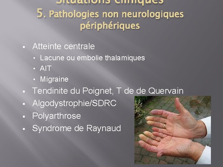 Situations cliniques 5. Pathologies non neurologiques périphériques § Atteinte centrale Lacune ou embolie thalamiques