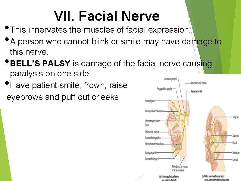 VII. Facial Nerve • This innervates the muscles of facial expression. • A person