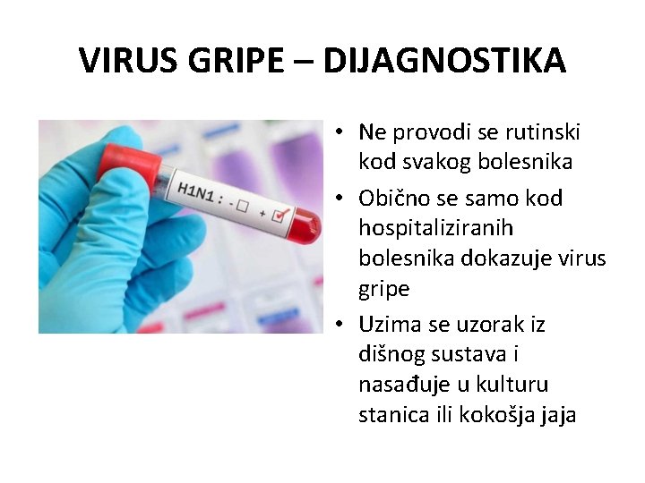 VIRUS GRIPE – DIJAGNOSTIKA • Ne provodi se rutinski kod svakog bolesnika • Obično