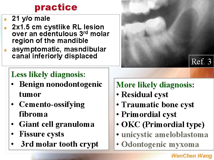 practice | | | 21 y/o male 2 x 1. 5 cm cystlike RL