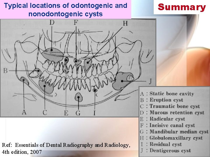 Typical locations of odontogenic and nonodontogenic cysts Ref: Essentials of Dental Radiography and Radiology,