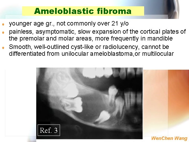 Ameloblastic fibroma | | | younger age gr. , not commonly over 21 y/o