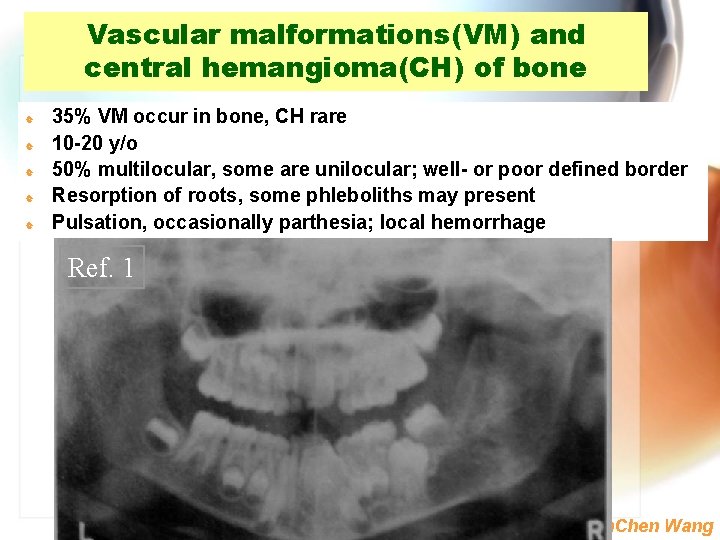 Vascular malformations(VM) and central hemangioma(CH) of bone | | | 35% VM occur in