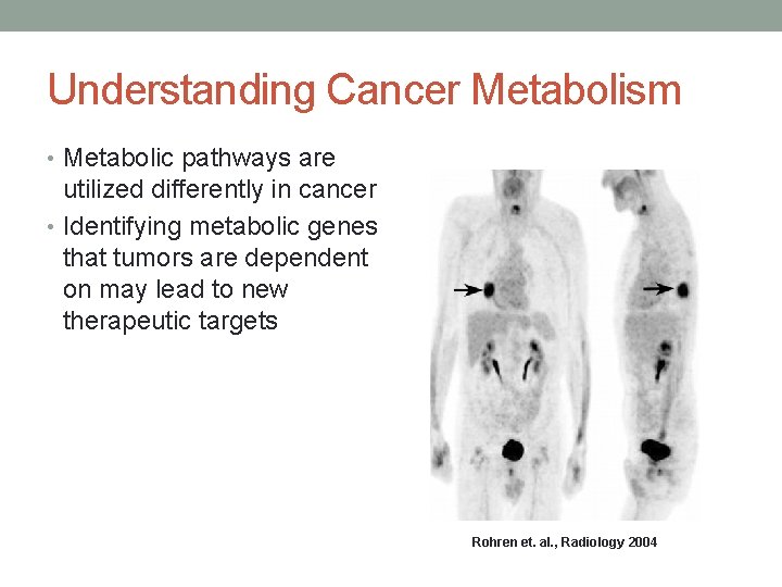 Understanding Cancer Metabolism • Metabolic pathways are utilized differently in cancer • Identifying metabolic Understanding Cancer Metabolism • Metabolic pathways are utilized differently in cancer • Identifying metabolic