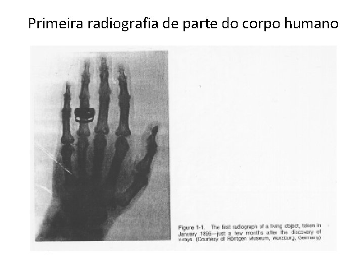 Primeira radiografia de parte do corpo humano 