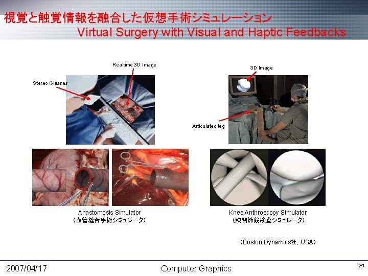 視覚と触覚情報を融合した仮想手術シミュレーション Virtual Surgery with Visual and Haptic Feedbacks Realtime 3 D Image Stereo Glasses