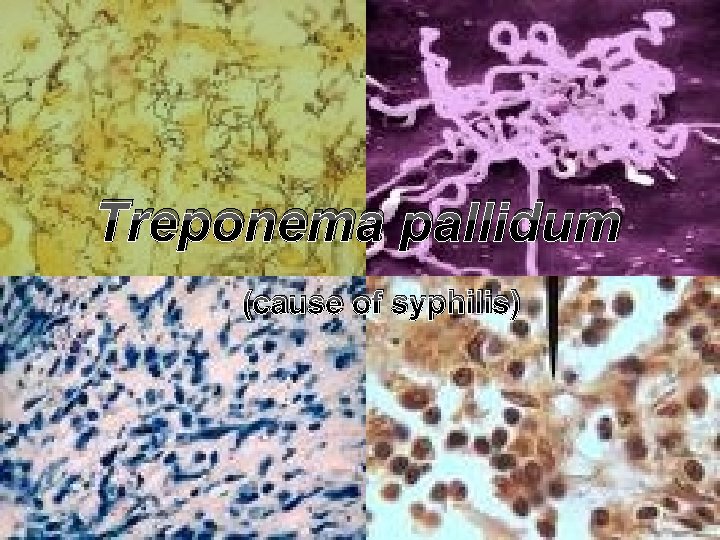 Treponema pallidum (cause of syphilis) Treponema pallidum (cause of syphilis)