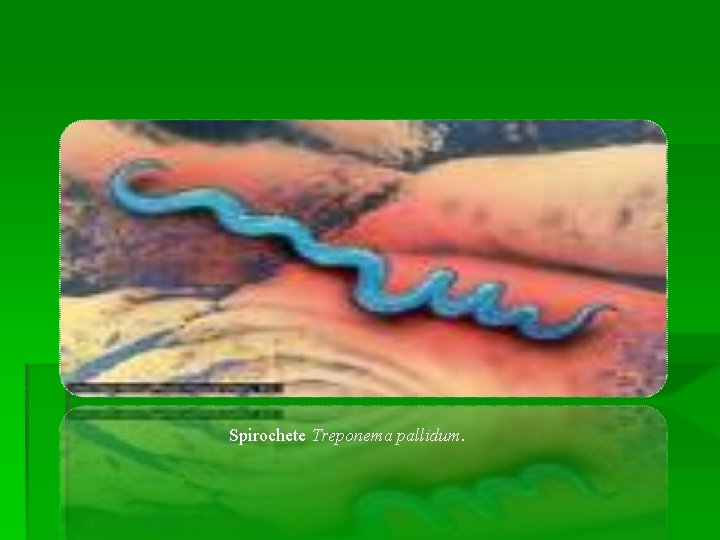 Spirochete Treponema pallidum. Spirochete Treponema pallidum.