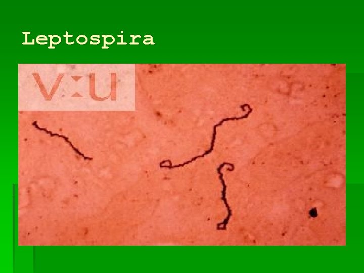 Leptospira Leptospira