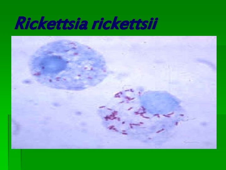 Rickettsia rickettsii Rickettsia rickettsii