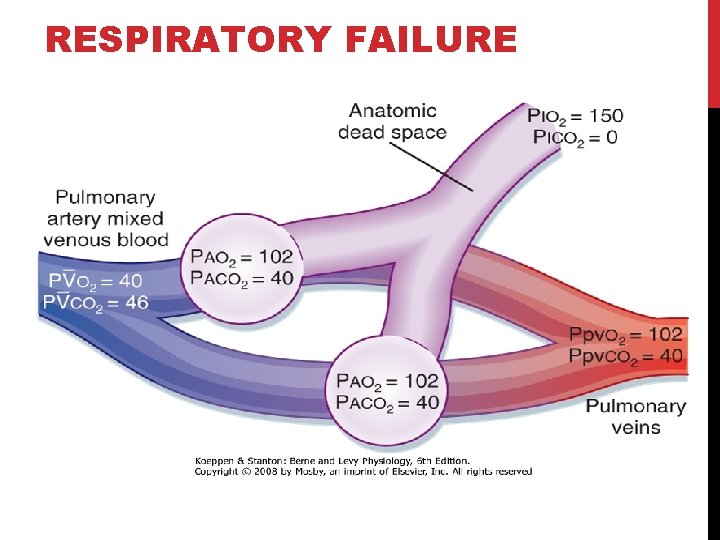 RESPIRATORY FAILURE 