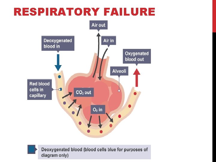 RESPIRATORY FAILURE 