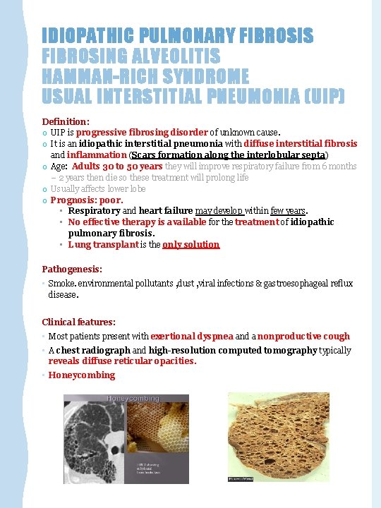 IDIOPATHIC PULMONARY FIBROSIS FIBROSING ALVEOLITIS HAMMAN-RICH SYNDROME USUAL INTERSTITIAL PNEUMONIA (UIP) Definition: o UIP