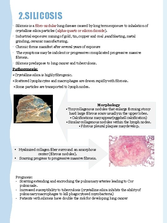 2. SILICOSIS • Silicosis is a fibro-nodular lung disease caused by long term exposure