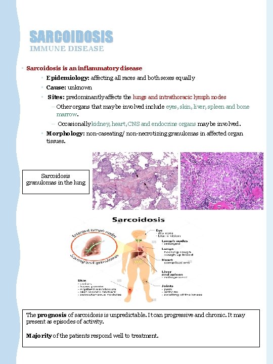 SARCOIDOSIS IMMUNE DISEASE • Sarcoidosis is an inflammatory disease • Epidemiology: affecting all races