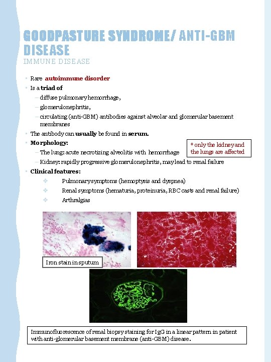 GOODPASTURE SYNDROME/ ANTI-GBM DISEASE IMMUNE DISEASE • Rare autoimmune disorder • Is a triad