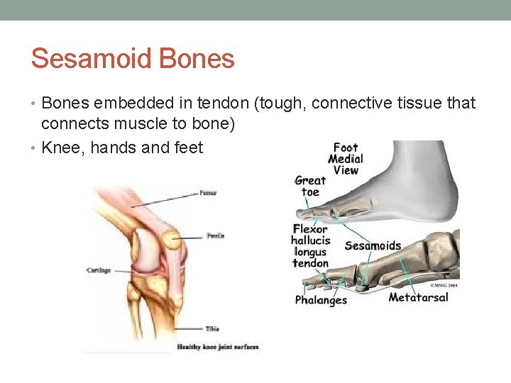Sesamoid Bones • Bones embedded in tendon (tough, connective tissue that connects muscle to